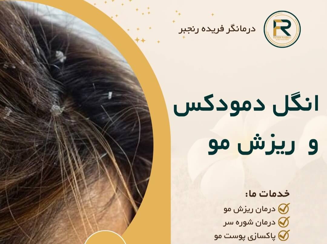 انگل دمودکس؛ مهمانان ناخوانده پوست و مژگان + راهکارهای علمی درمان